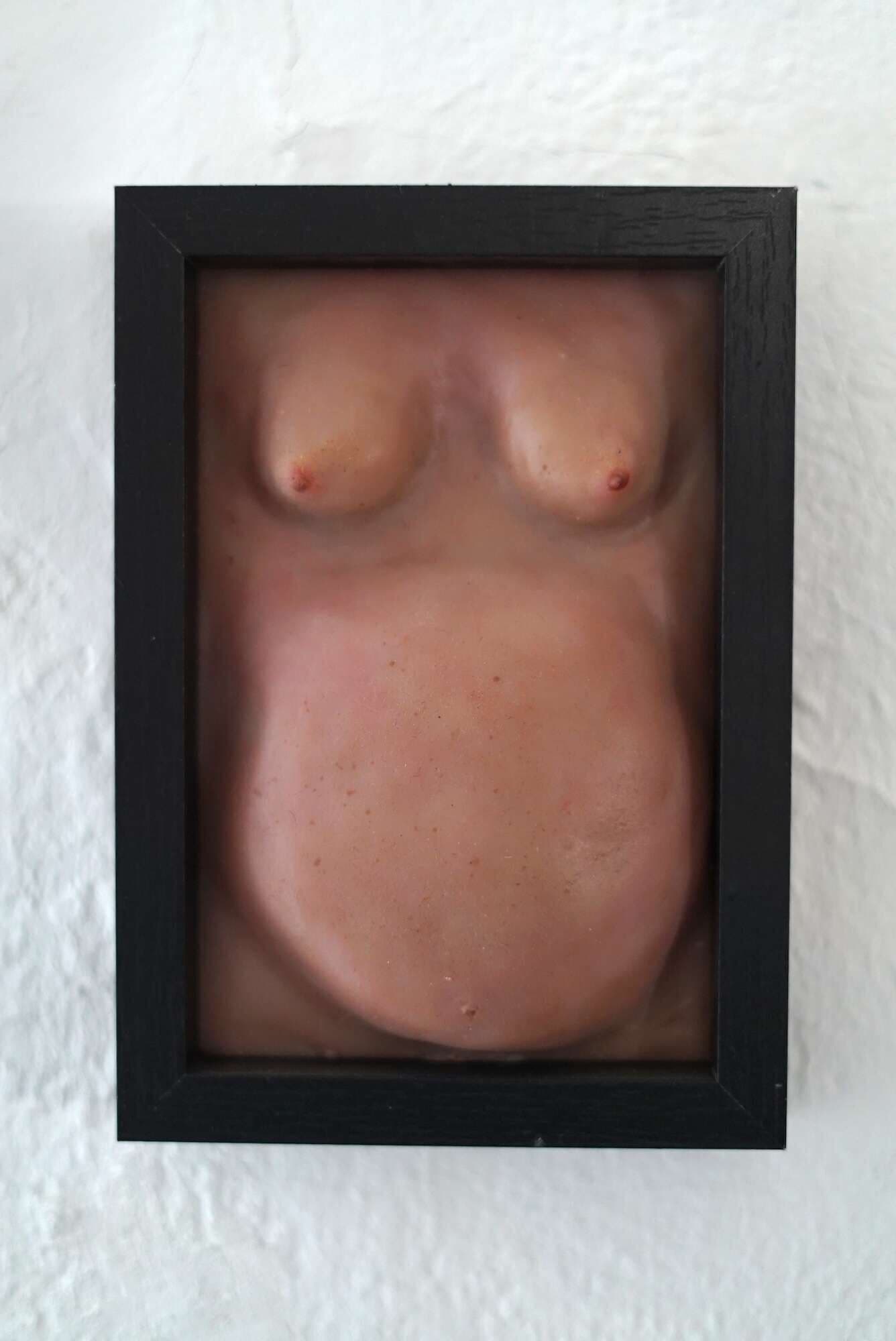Wohlstandsbauch X