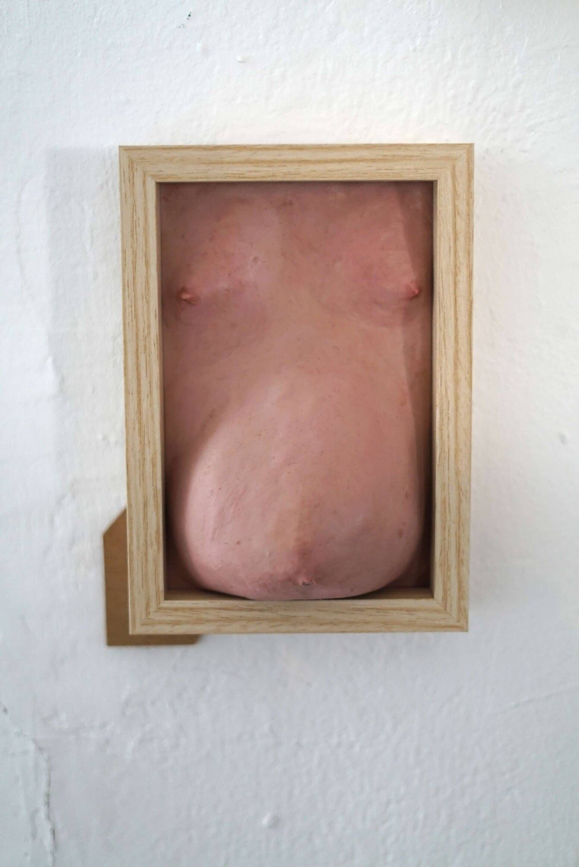Wohlstandsbauch IX